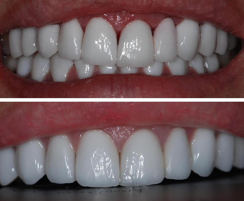 Tendências Harmonização Orofacial 2019