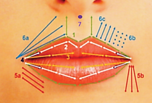 Harmonização Orofacial Lábios