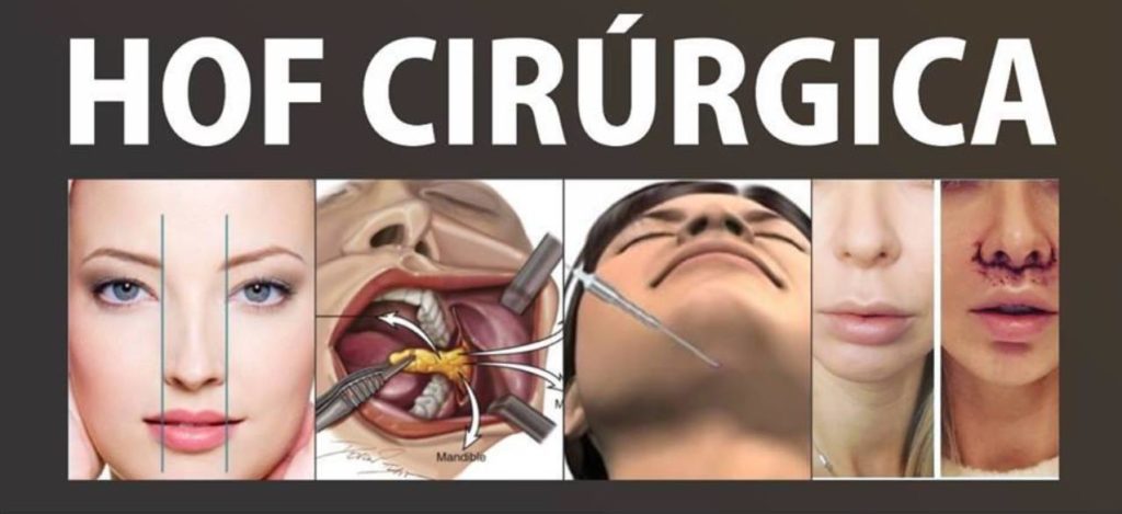 Cirurgias da Harmonização Orofacial HOF Cirúrgica