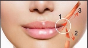Leia mais sobre o artigo Cirurgias de Lábios na Harmonização Orofacial – Conheça 3 na Região