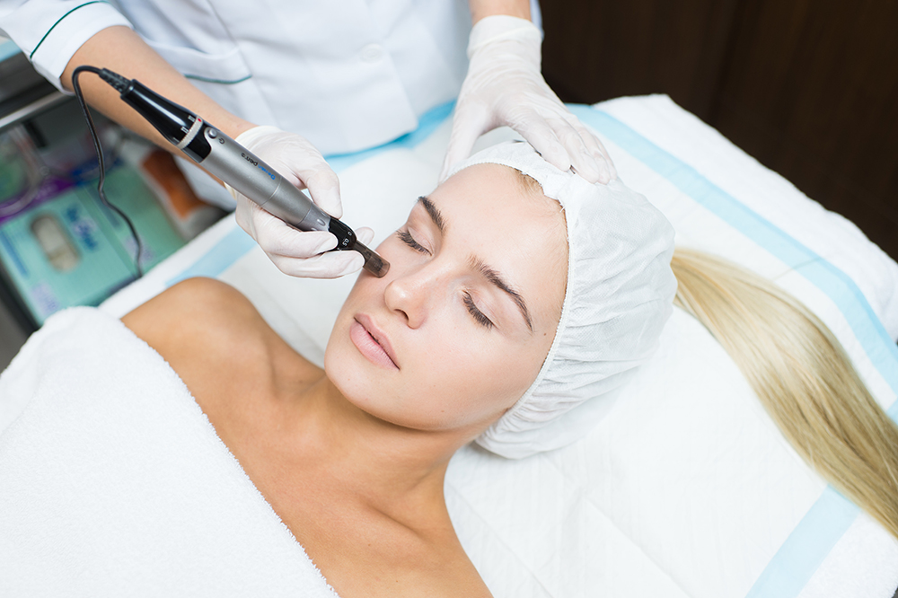 Dermapen-Skin-Needling-Skin-Carea-Australia-Clinis-Westfield-Whitfords-and-Carousel