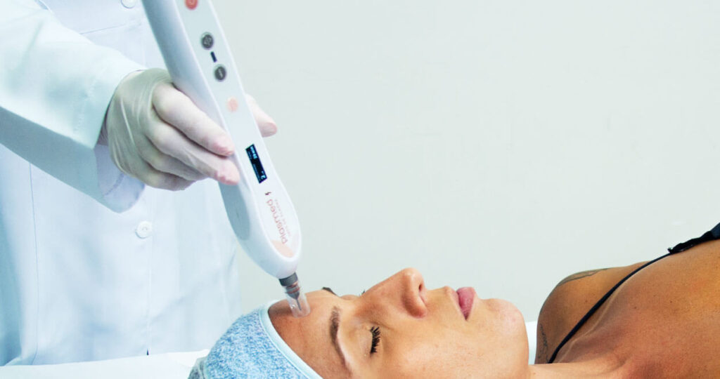 Jato de Plasma Plasmed Ibramed