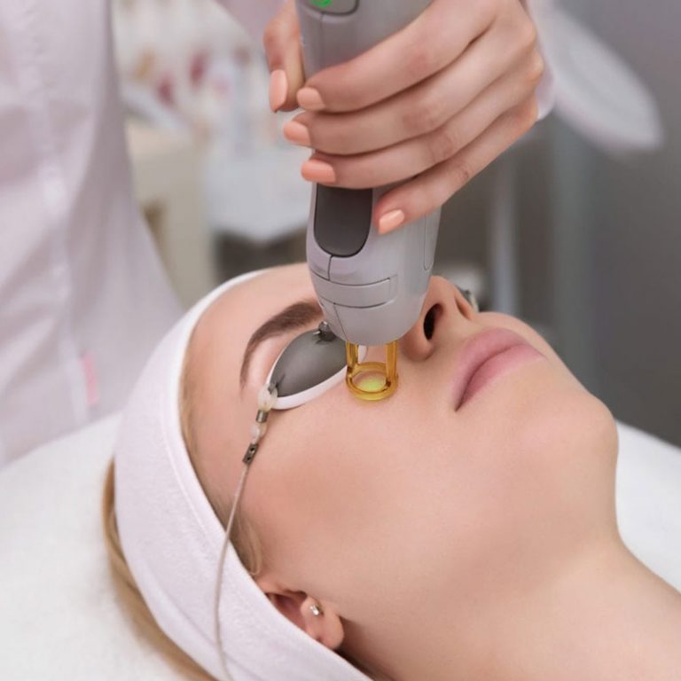 No momento, você está visualizando Laser CO2 Fracionado na Harmonização Orofacial