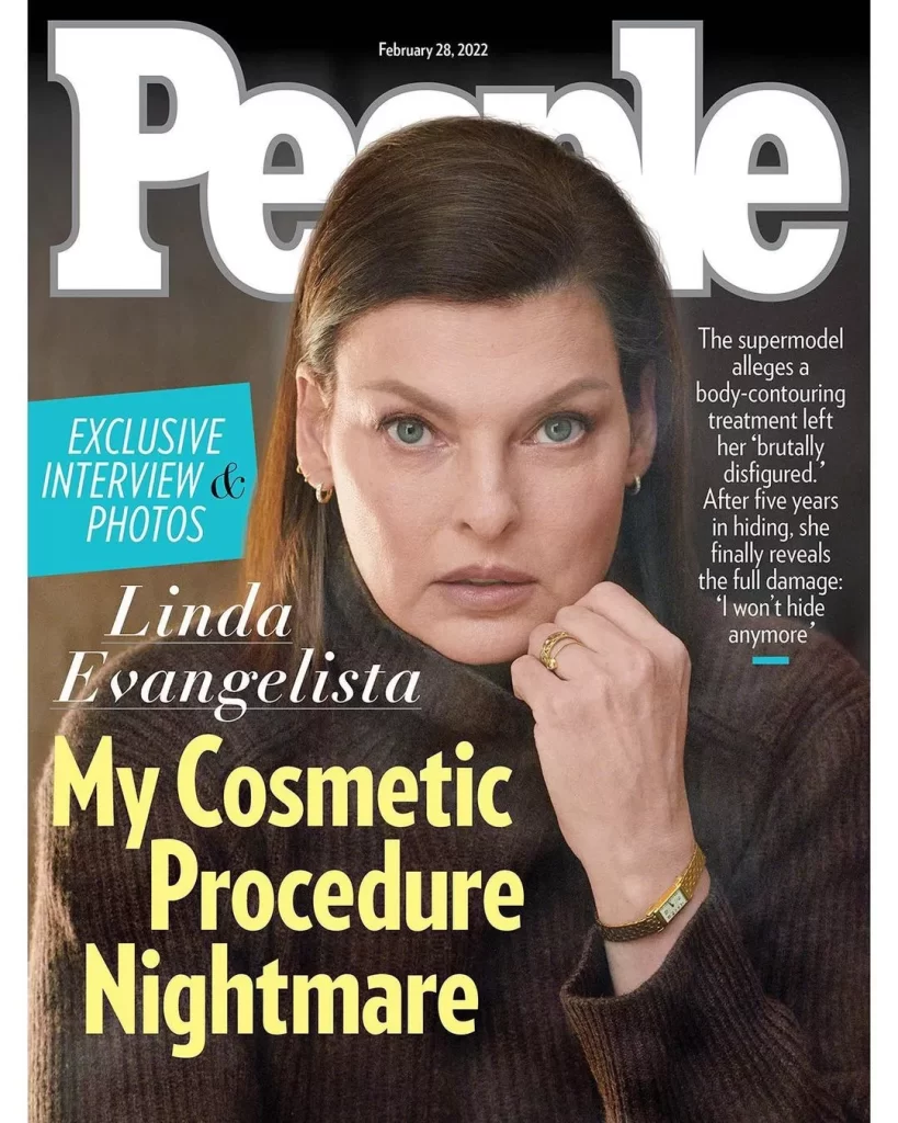 Linda Evangelista - 7 celebridades de Hollywood que fizeram harmonização facial